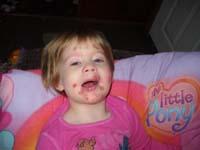 Impetigo Baby Picture 3 Thumbnail image