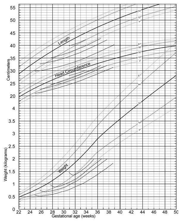 Premature baby growth chart. This figure was extracted under open source