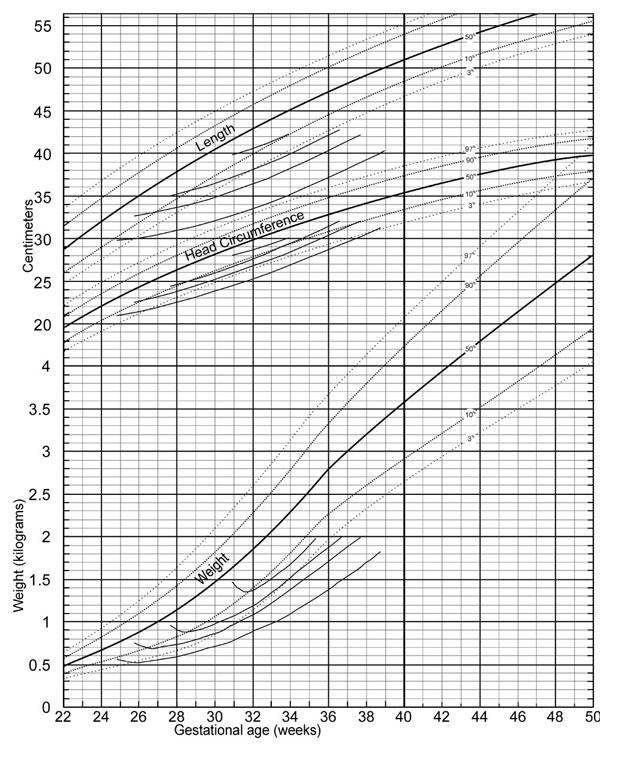 Baby Growth Chart Head Circumference