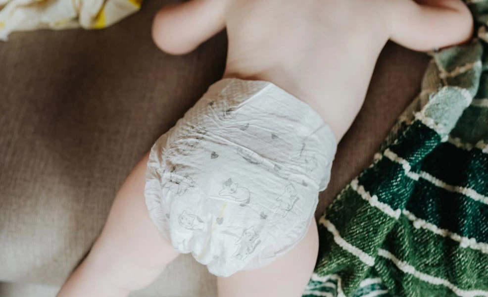a baby getting his diaper changed