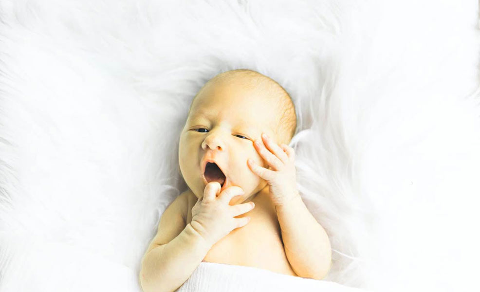 infant jaundice