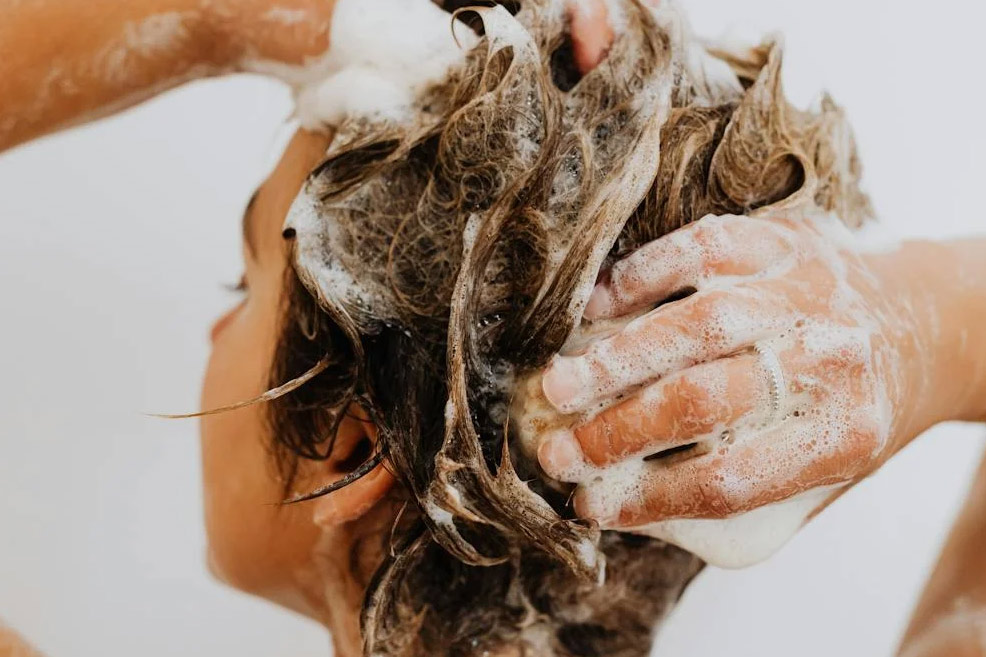 breastfeeding woman with hair loss