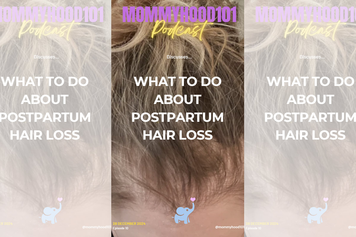 podcast how to deal with postpartum hair loss