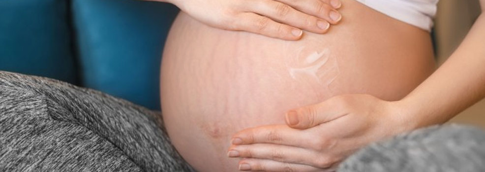 stretch marks during pregnancy