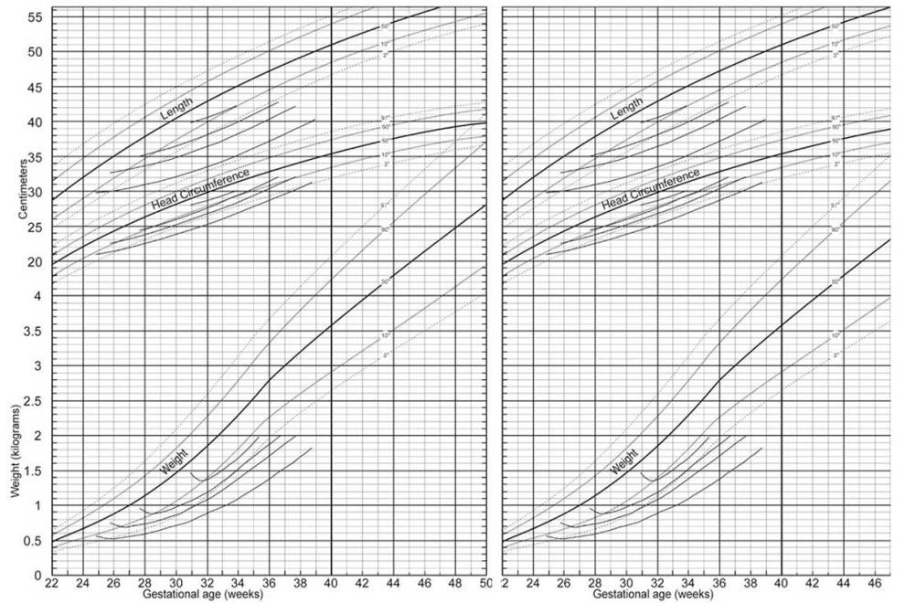 New Growth Chart for Premature Babies