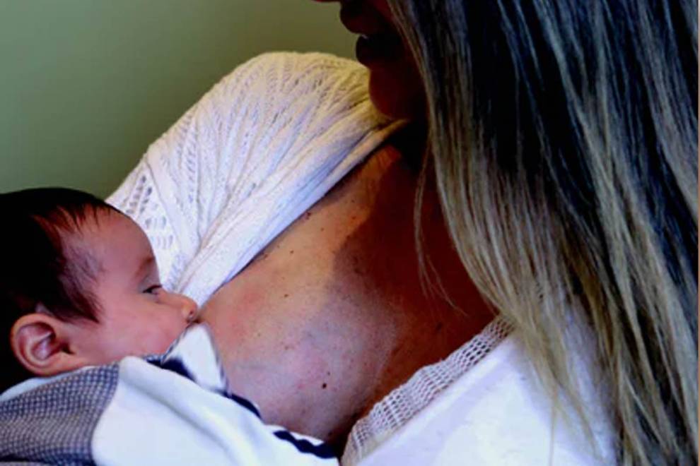 Breast Engorgement During Breastfeeding